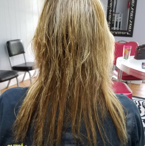 Gut Health Symptoms - Hair Falling Out