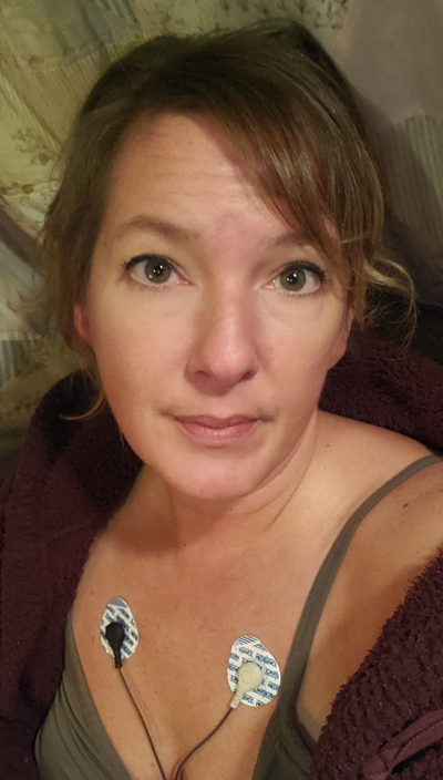 Long Covid Heart Rate Issues