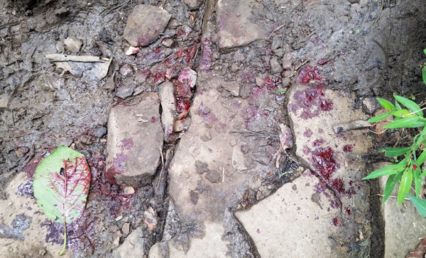 Ozone Falls Hiking Injury